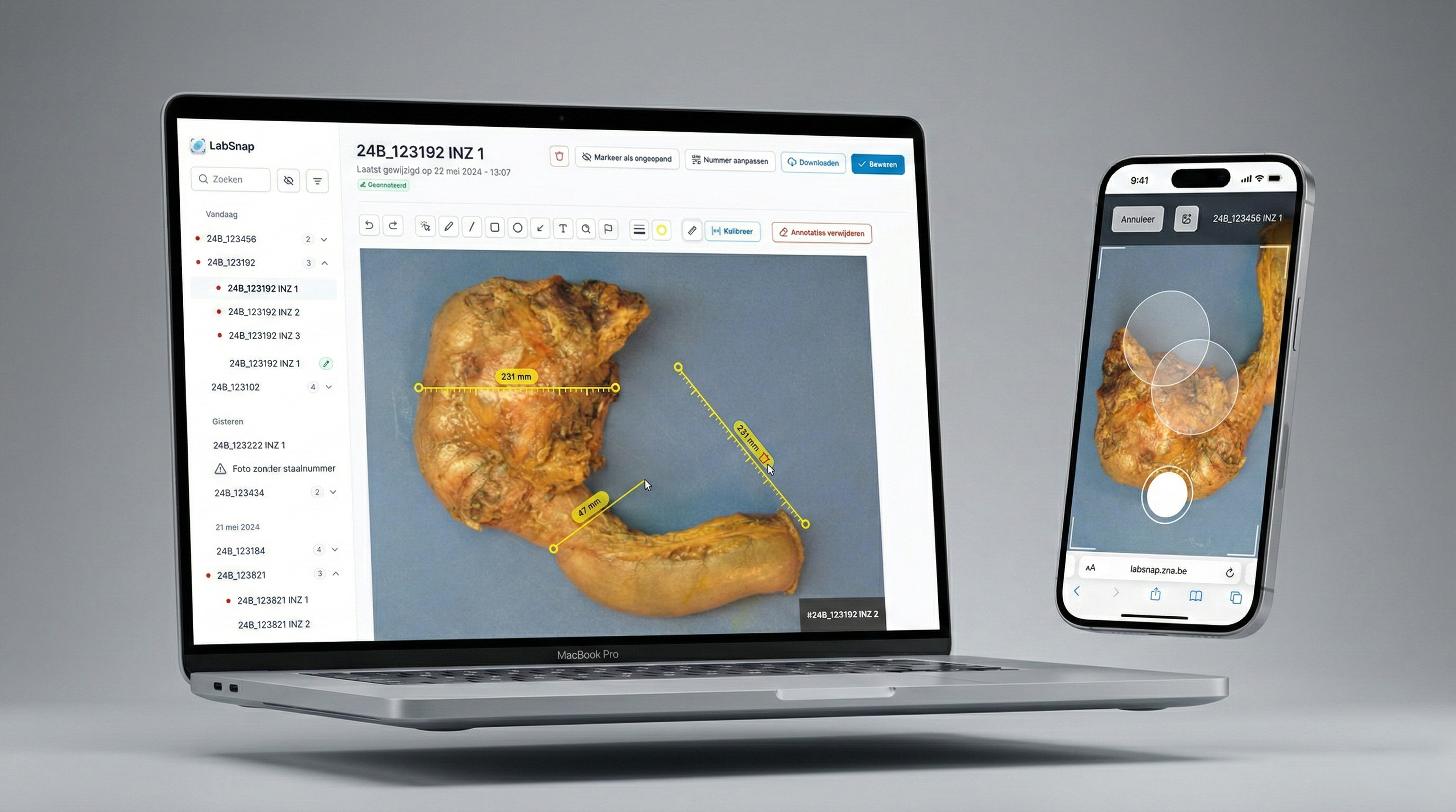Screenshot of LabSnap PWA: lab documentation interface for tissue sample capture and annotation